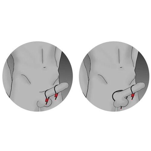 ELECTRASTIM - PRESTIGE ELECTRA LOOPS ANILLOS DE PENE AJUSTABLES ROJO